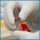 Complications Associated with High Cholesterol
